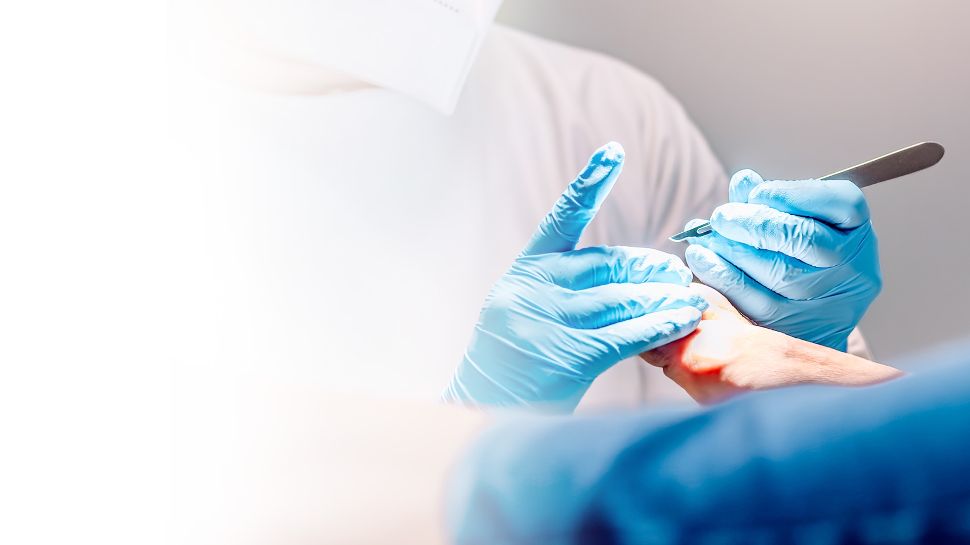 Nail Surgery Image